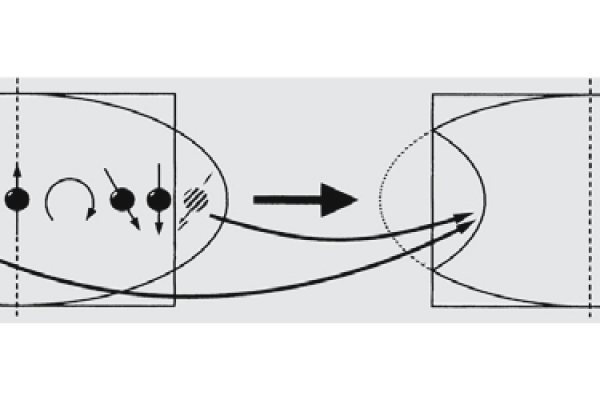 101MRI-39