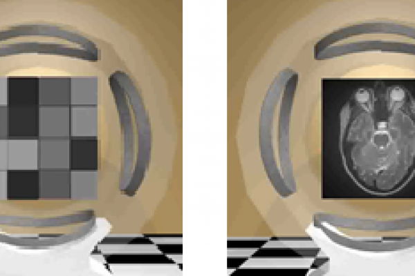 621MRI-37