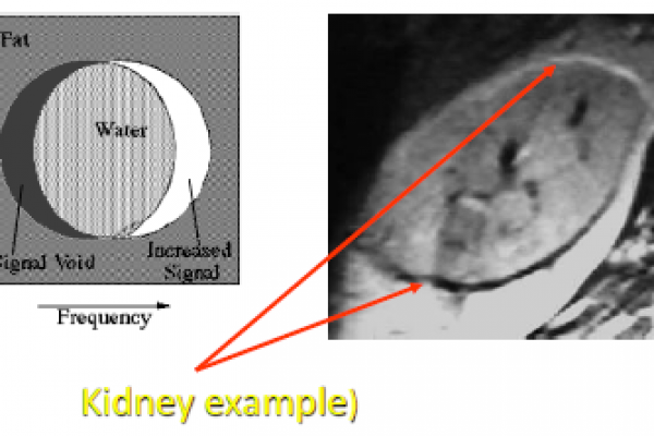 671MRI-40