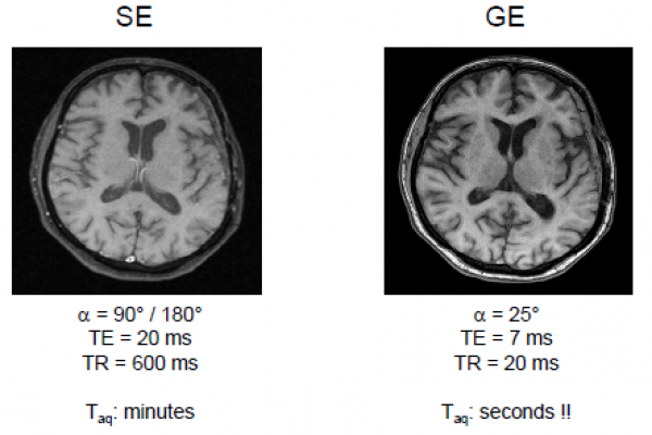 901MRI-33-2